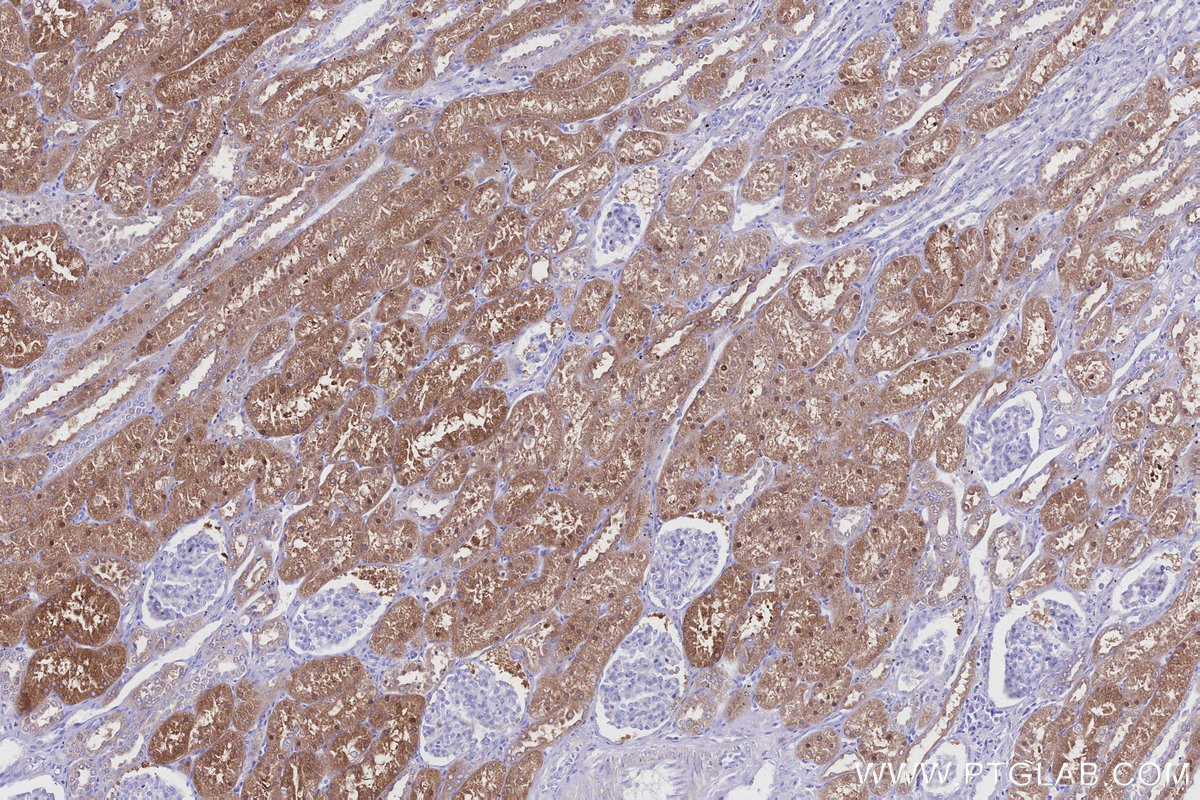 IHC staining of human kidney using 17390-1-AP