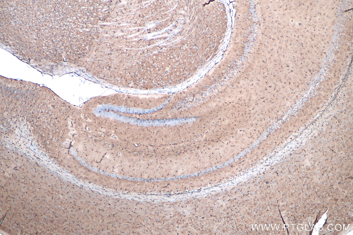 IHC staining of mouse brain using 68018-1-Ig