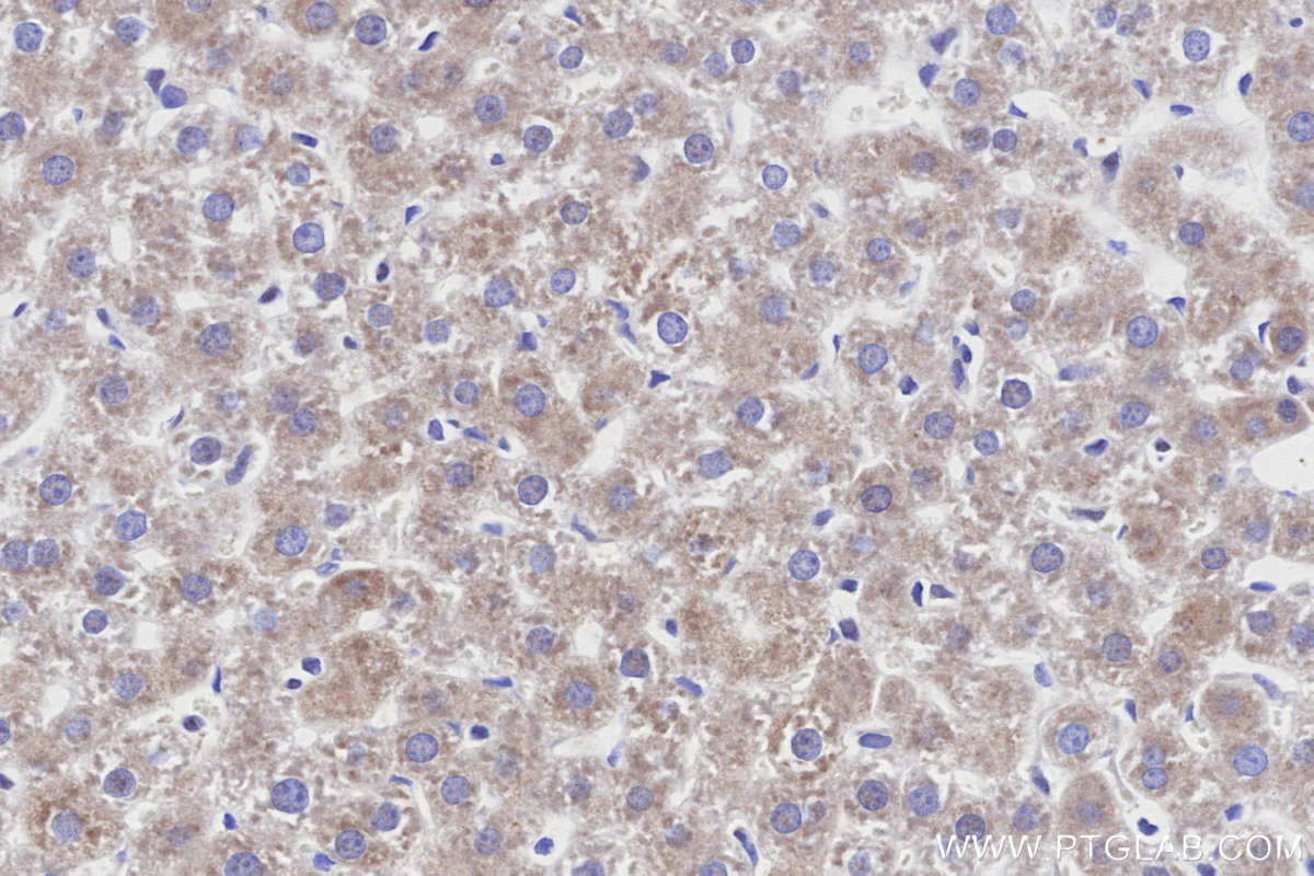 IHC staining of rat liver using 85980-2-RR