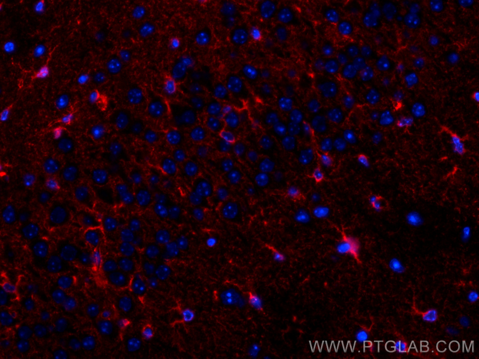 IF Staining of mouse brain using CL594-68018