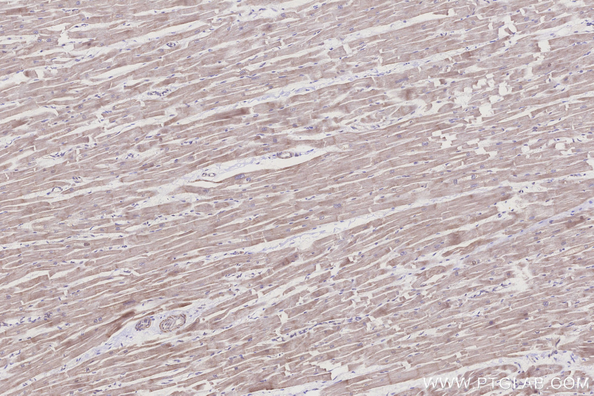 IHC staining of human heart using 21391-1-AP IHC staining of human heart using 21391-1-AP