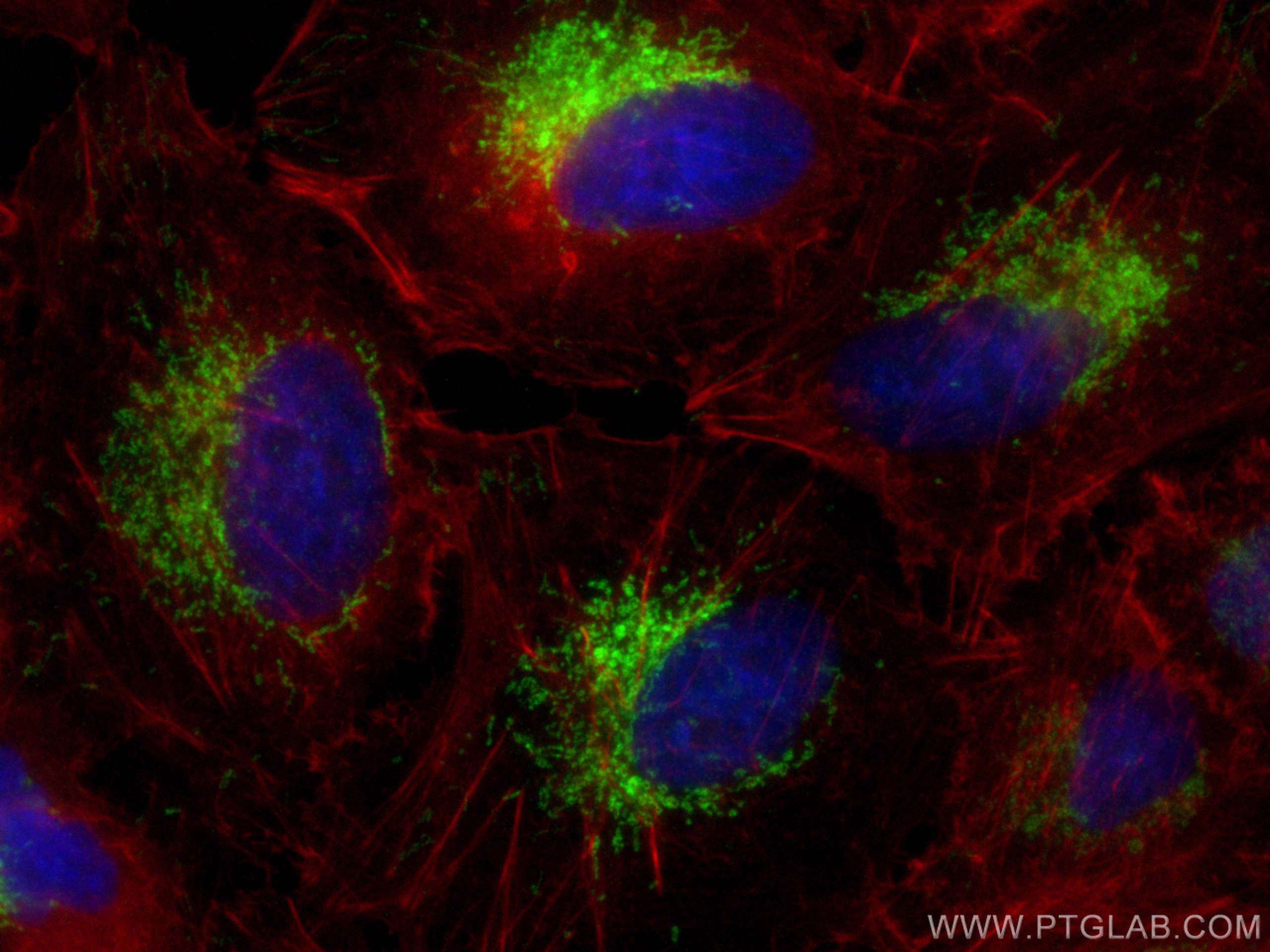 IF Staining of A549 using 15310-1-AP