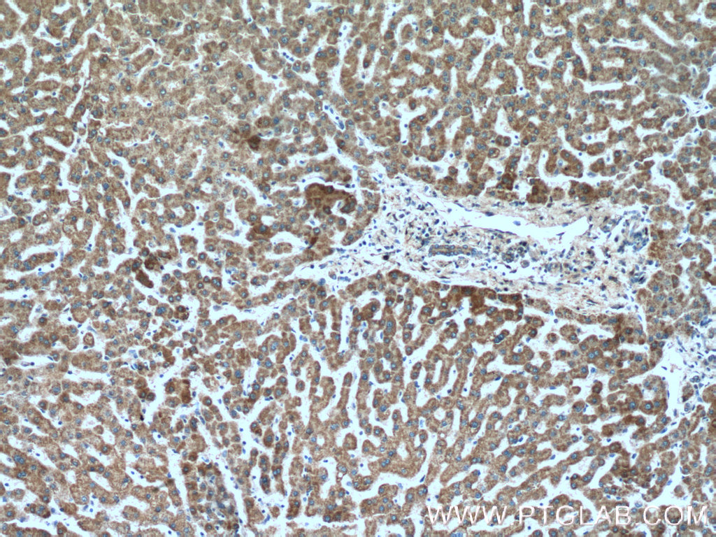 IHC staining of human liver using 15310-1-AP