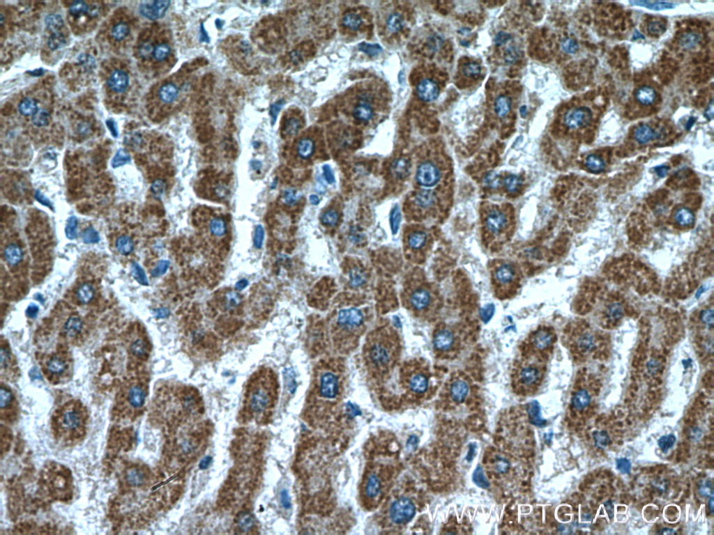 IHC staining of human liver using 15310-1-AP