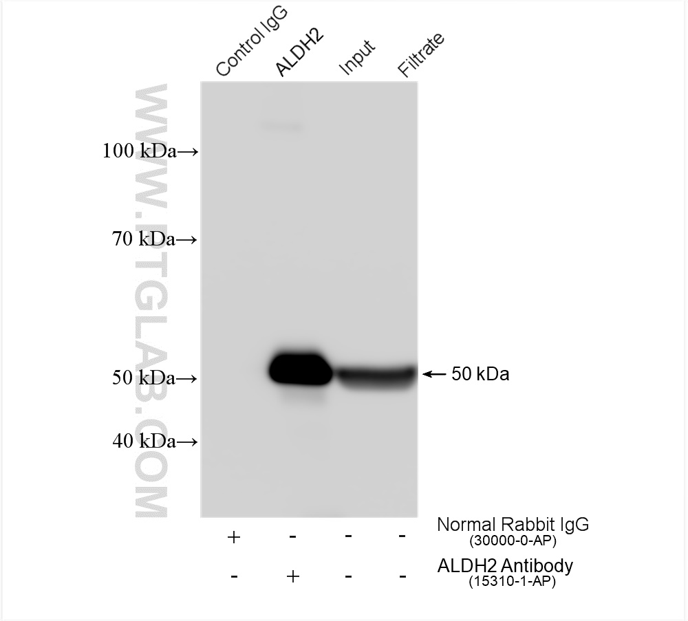 IP experiment of HepG2 using 15310-1-AP