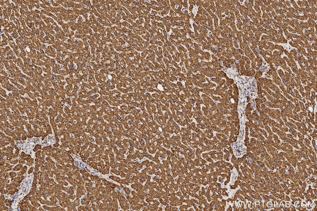 IHC staining of human liver using 86429-5-RR