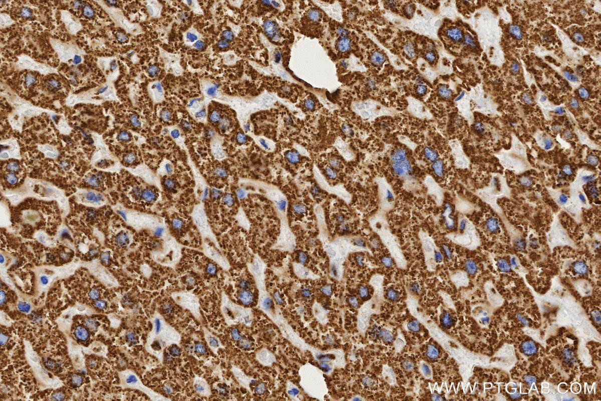 IHC staining of human liver using 86429-5-RR
