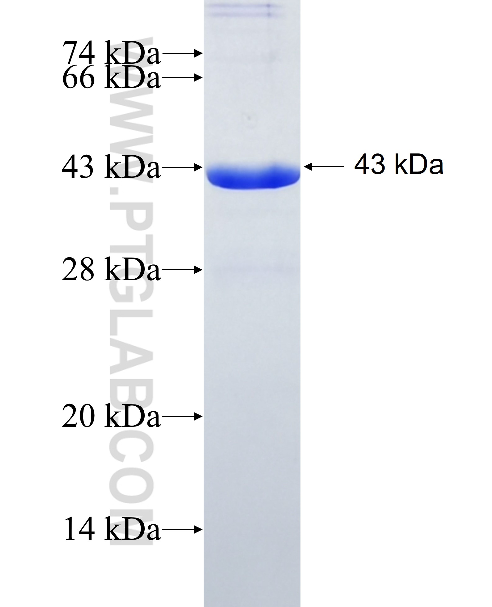 ALDH2 fusion protein Ag7463 SDS-PAGE