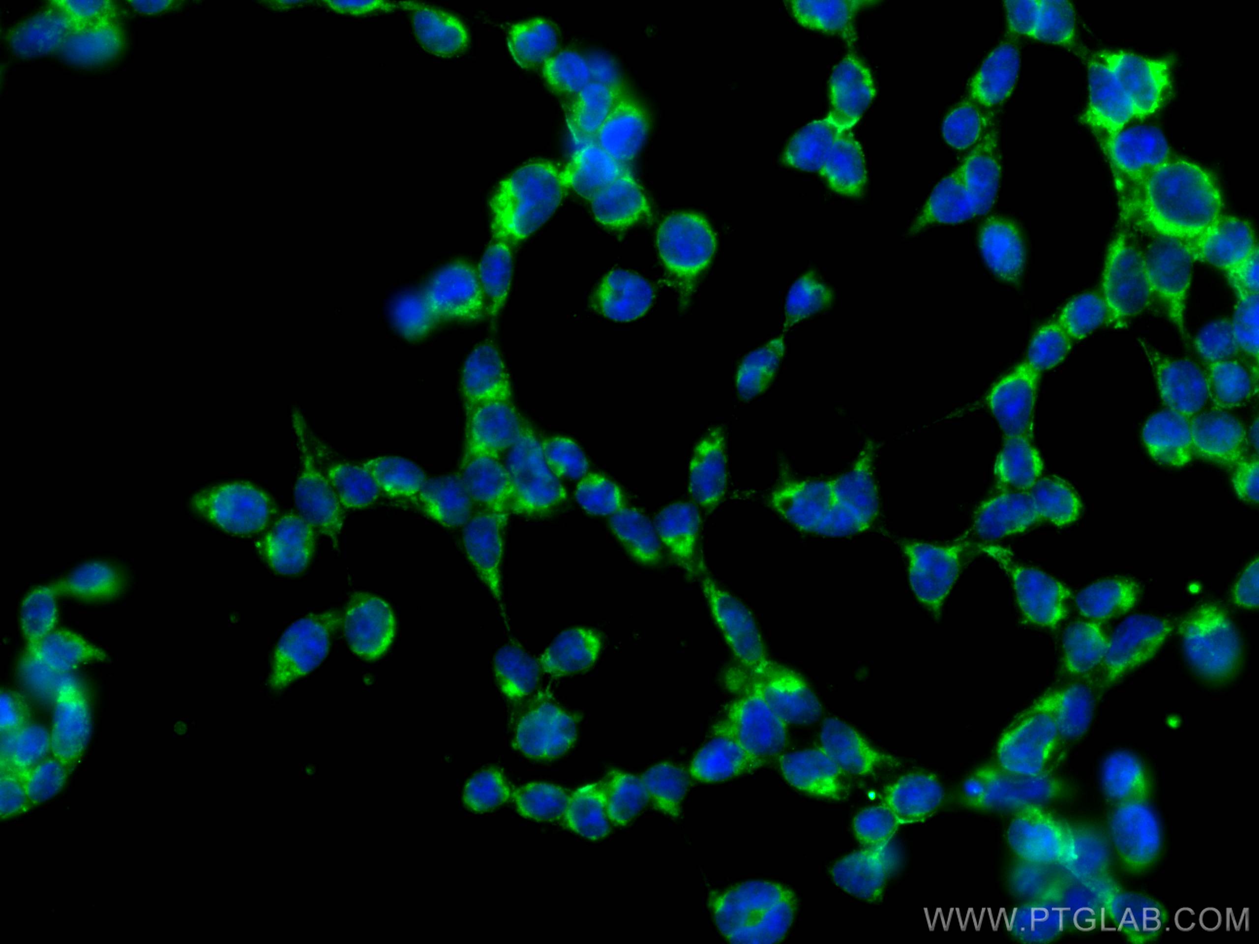 IF Staining of HEK-293T using 15578-1-AP