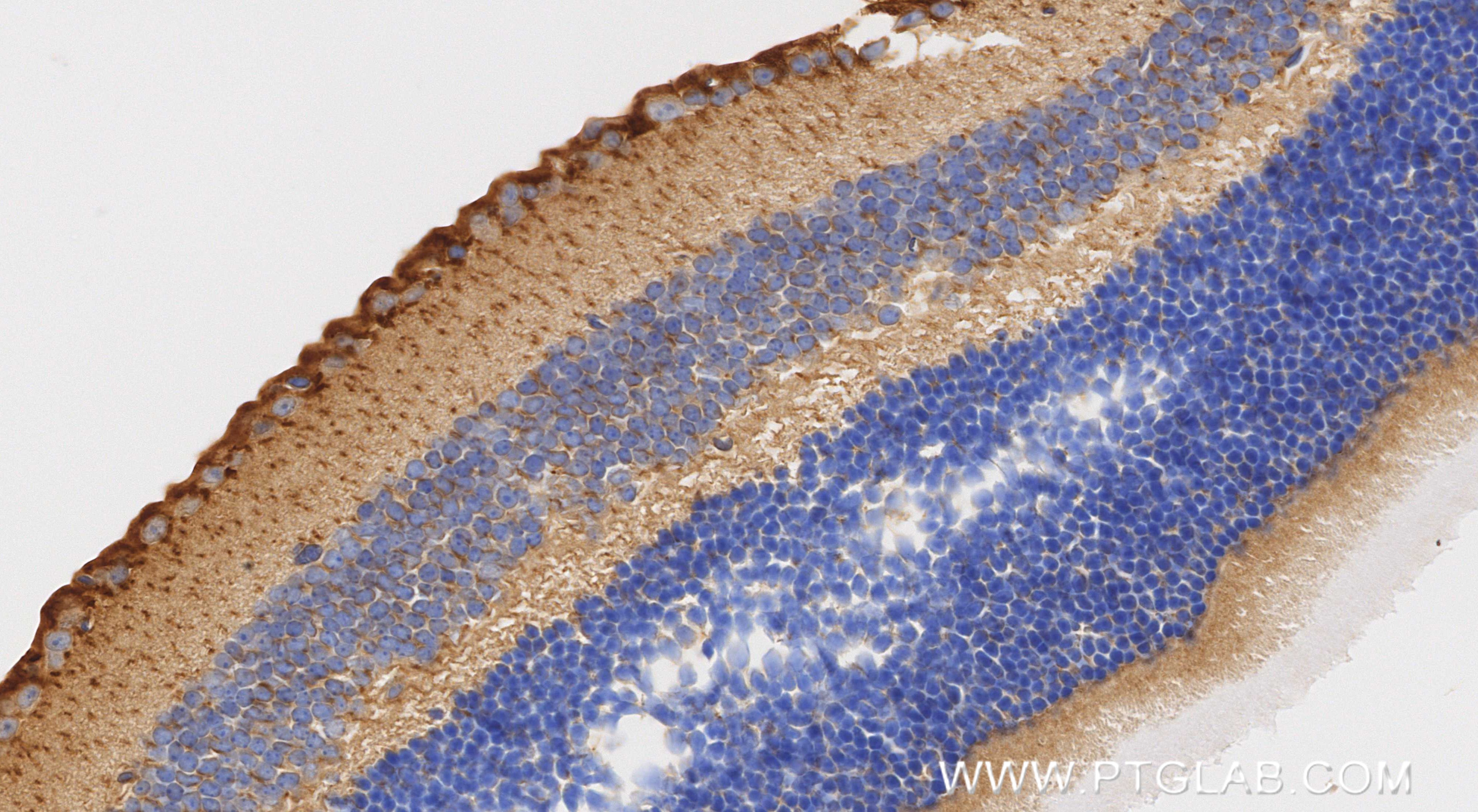 IHC staining of mouse eye using 85725-1-RR