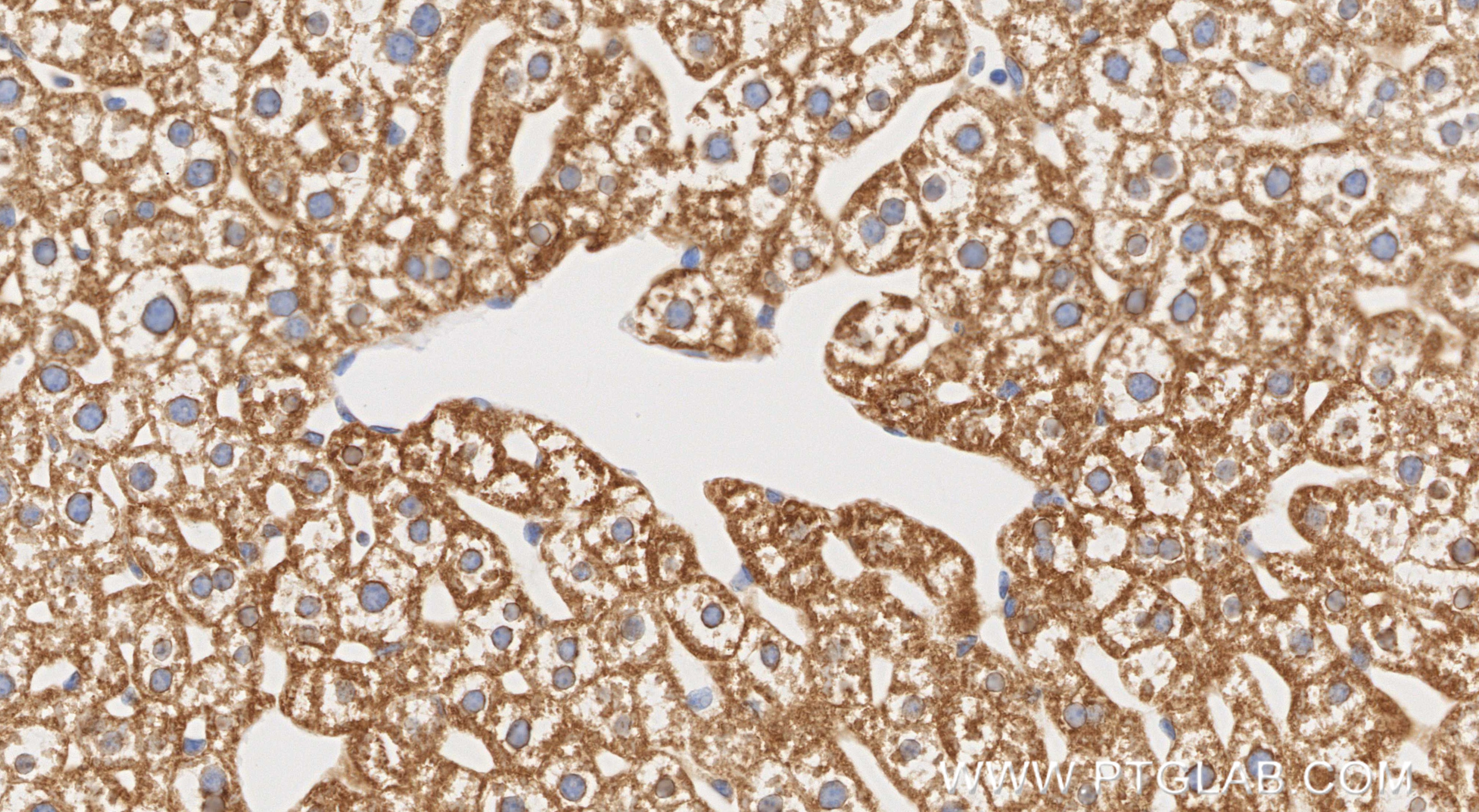 IHC staining of mouse liver using 85725-1-RR