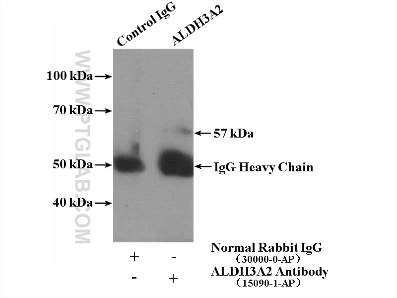 IP experiment of HEK-293 using 15090-1-AP