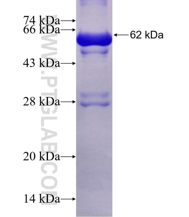 ALDH3A2 fusion protein Ag1687 SDS-PAGE