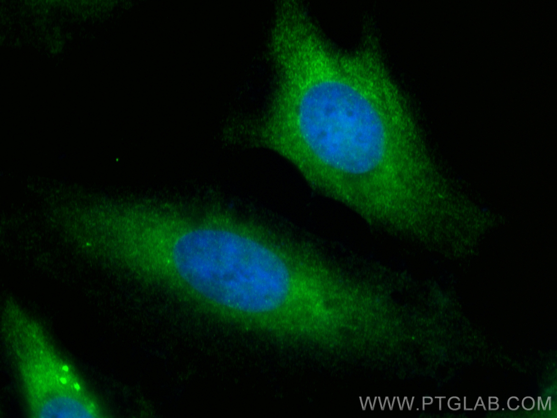IF Staining of HeLa using 15746-1-AP