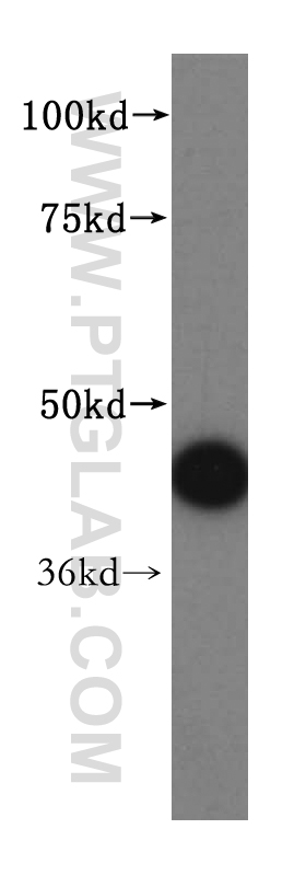 WB analysis of mouse lung using 15746-1-AP