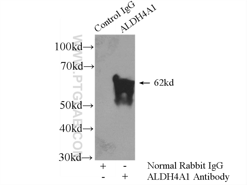 IP experiment of mouse skeletal muscle using 11604-1-AP