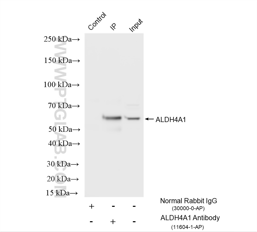IP experiment of mouse heart using 11604-1-AP IP experiment of mouse heart using 11604-1-AP
