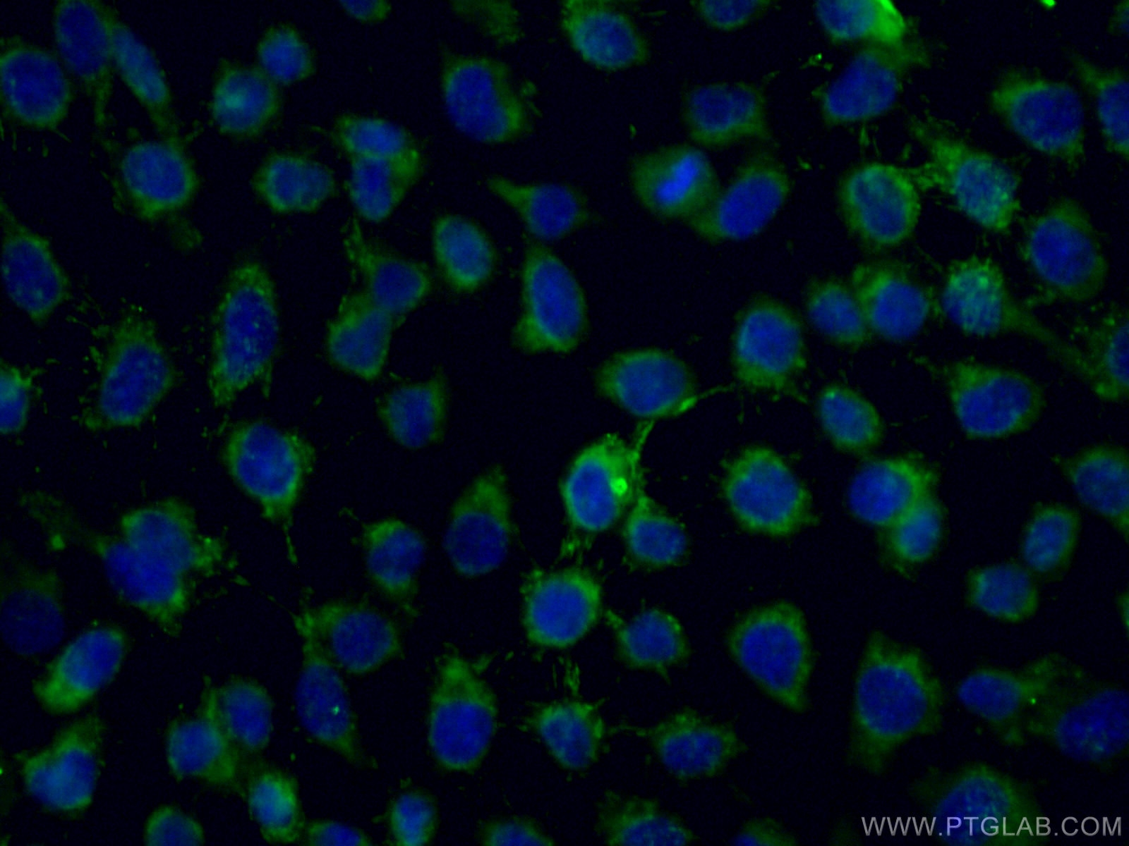 IF Staining of A431 using 17319-1-AP