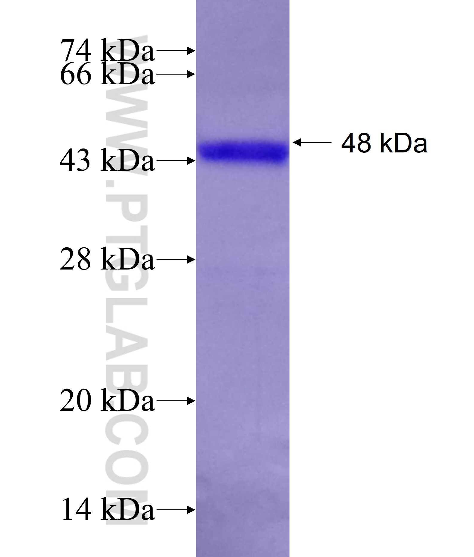 ALDH5A1 fusion protein Ag11155 SDS-PAGE