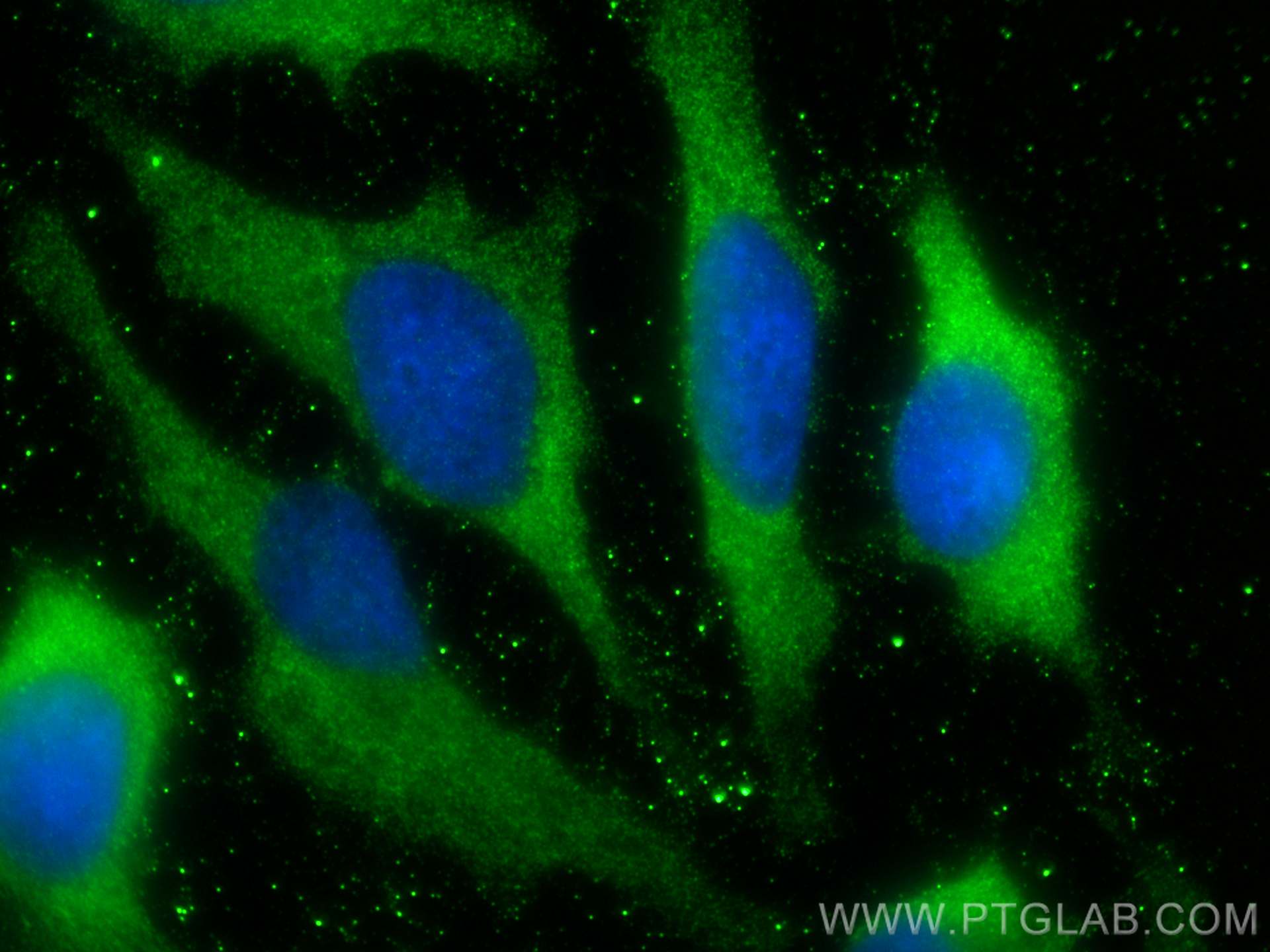 IF Staining of HeLa using 80837-1-RR