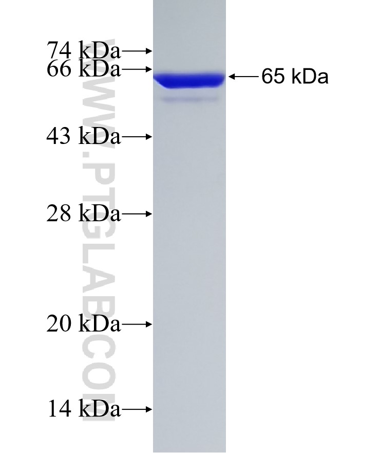 ALDOA fusion protein Ag1726 SDS-PAGE