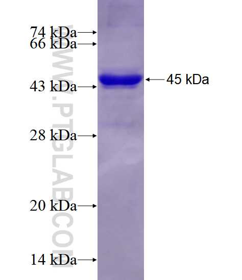 ALDOA fusion protein Ag17952 SDS-PAGE