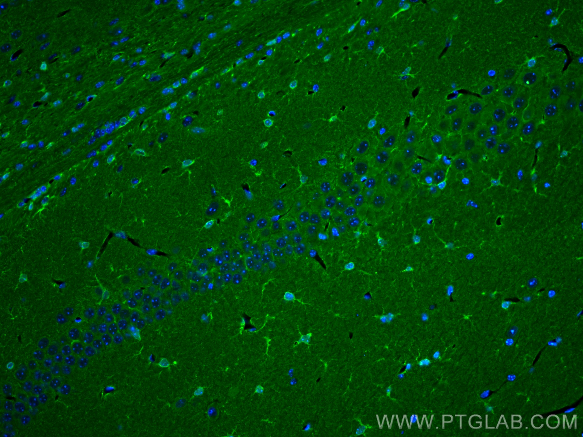 IF Staining of mouse brain using 14884-1-AP