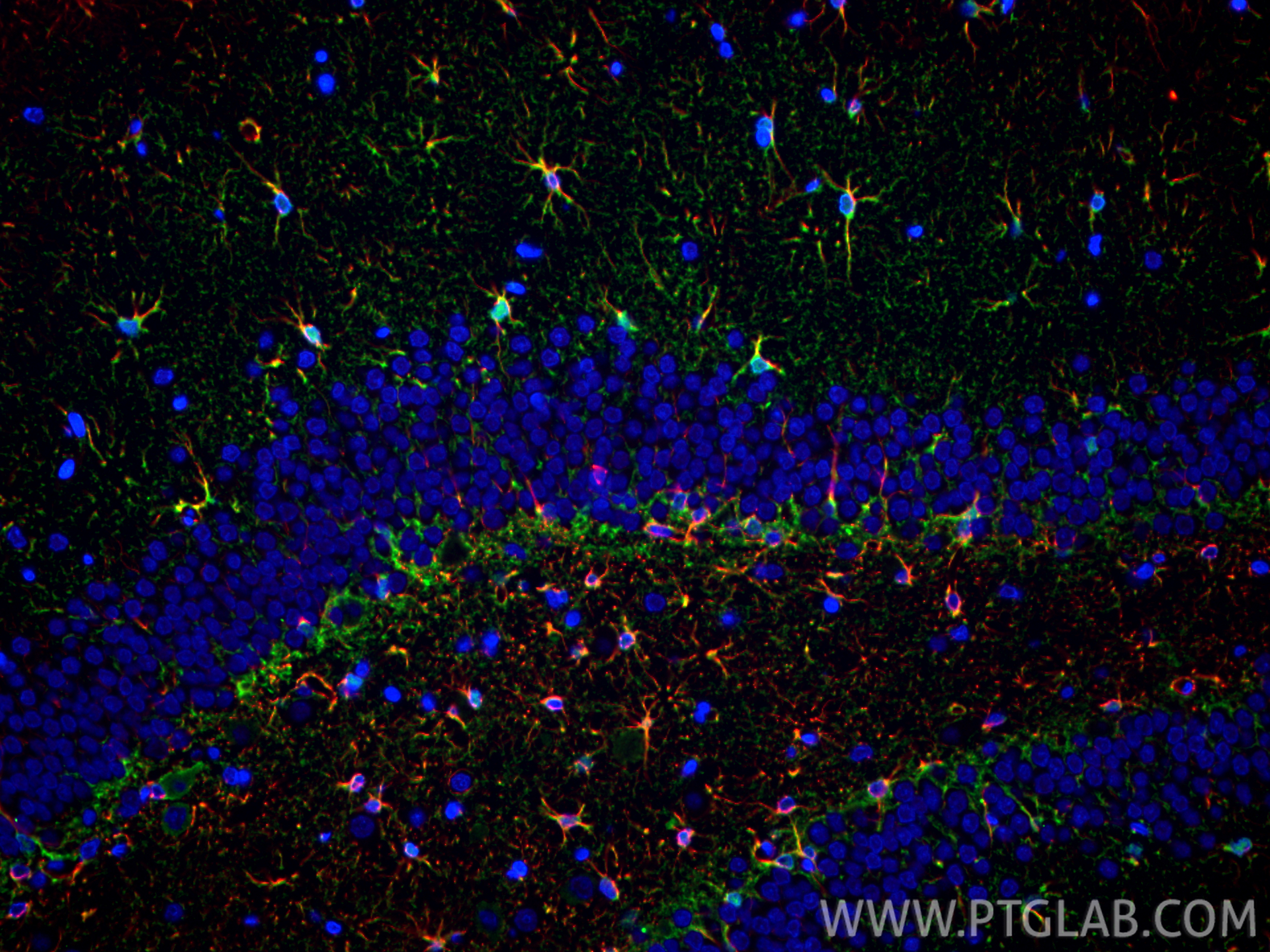 Immunofluorescent analysis of (4% PFA) fixed paraffin-embedded rat brain tissue using Aldolase C antibody (14884-1-AP) at dilution of 1:400 and CoraLite®488-Conjugated Goat Anti-Rabbit IgG(H+L) (<a class='green' href='/productredirect?CatalogNo=SA00013-2' target='_blank'>SA00013-2</a>), GFAP antibody (<a class='green' href='/productredirect?CatalogNo=60190-1-Ig' target='_blank'>60190-1-Ig</a>, Clone: 4B2E10, red). Heat mediated antigen retrieval with Tris-EDTA buffer (pH 9.0). IF Staining of rat brain using 14884-1-AP