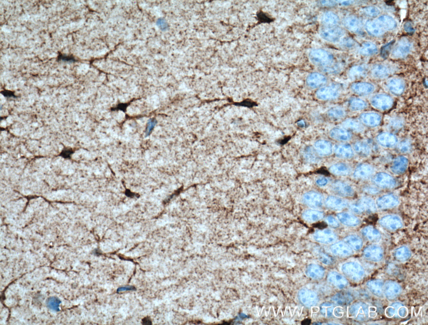 IHC staining of mouse brain using 14884-1-AP