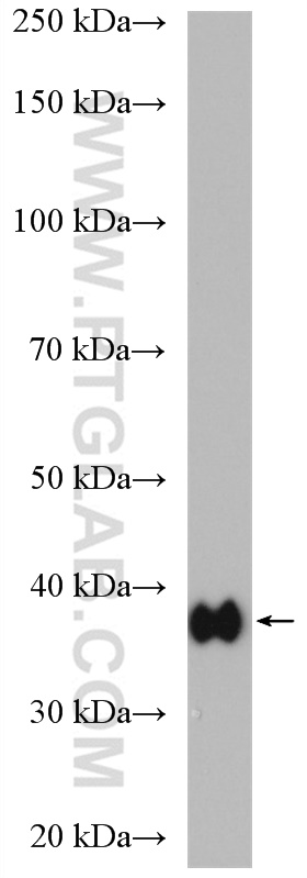 WB analysis of mouse cerebellum using 14884-1-AP