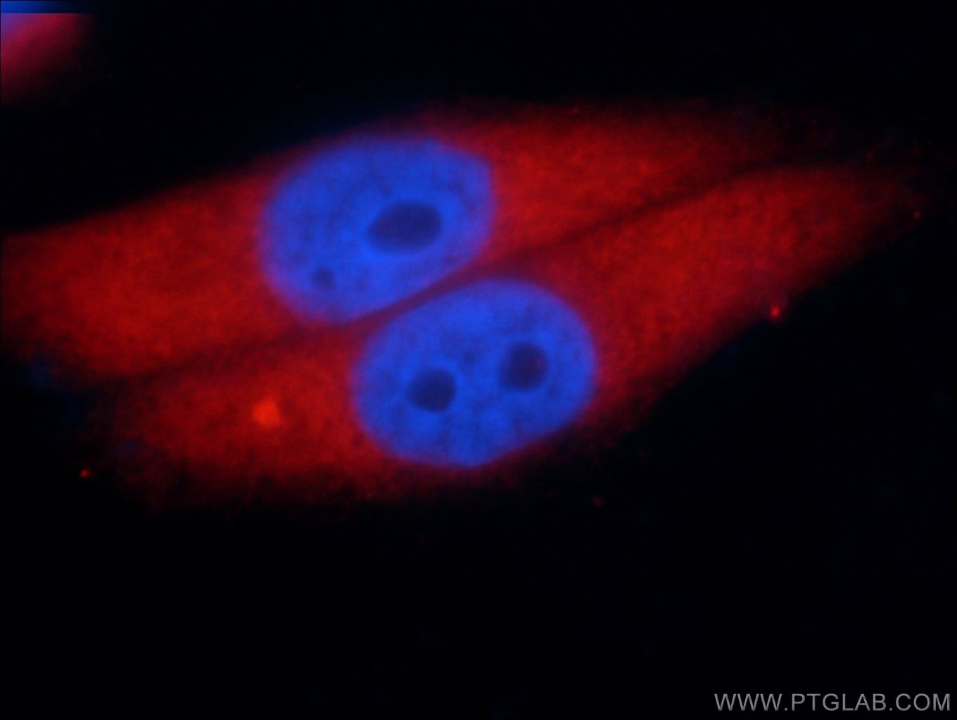 IF Staining of HepG2 using 66120-1-Ig