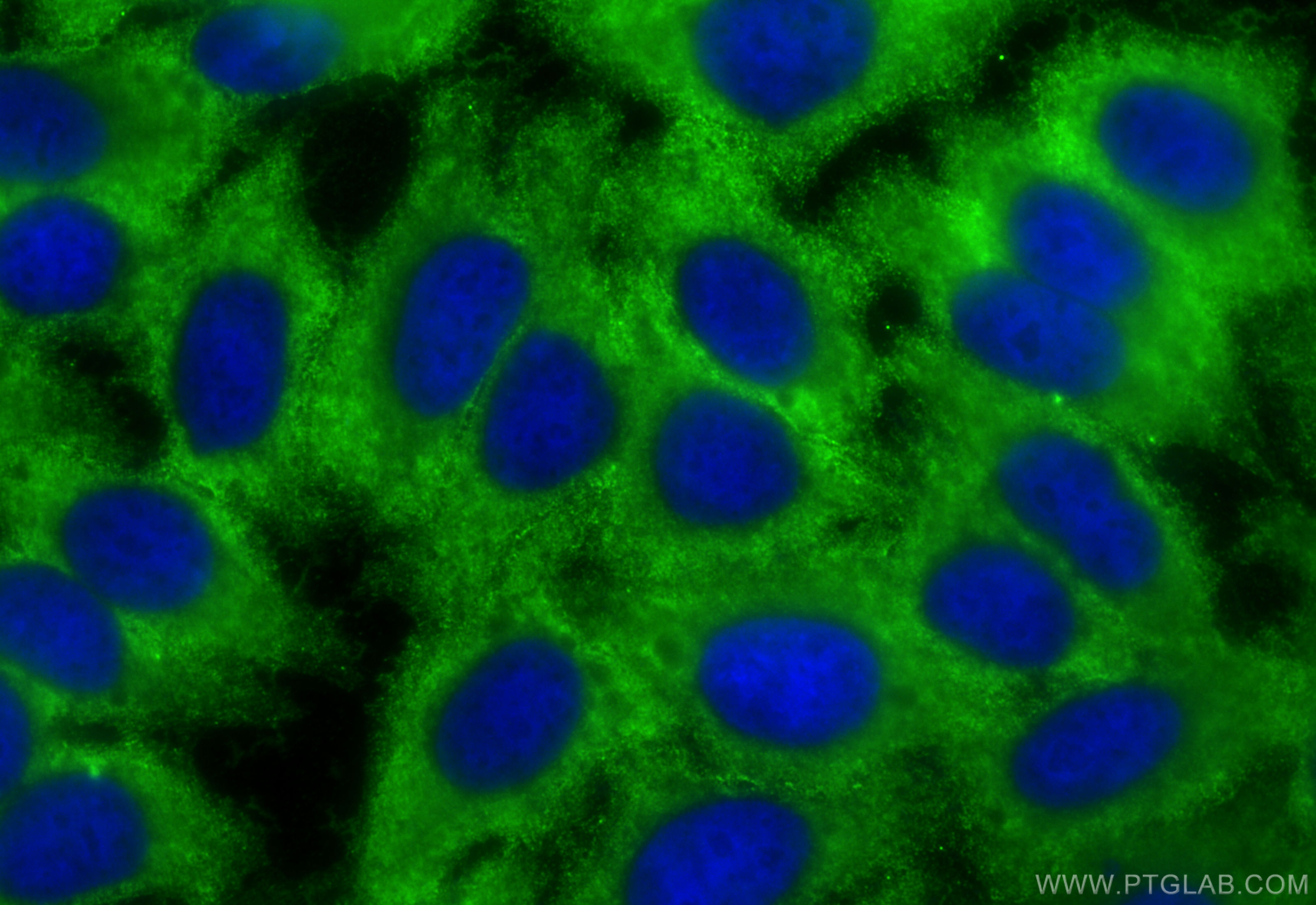 IF Staining of HepG2 using 66120-1-Ig (same clone as 66120-1-PBS)