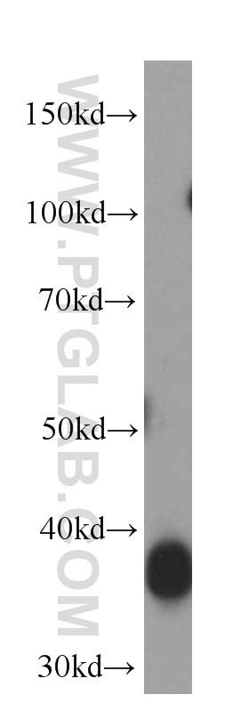 WB analysis of human heart using 66120-1-Ig (same clone as 66120-1-PBS)