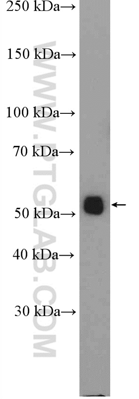 WB analysis of mouse brain using 27085-1-AP