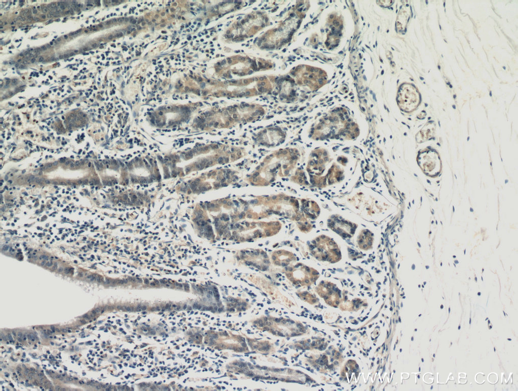 IHC staining of human stomach using 20810-1-AP