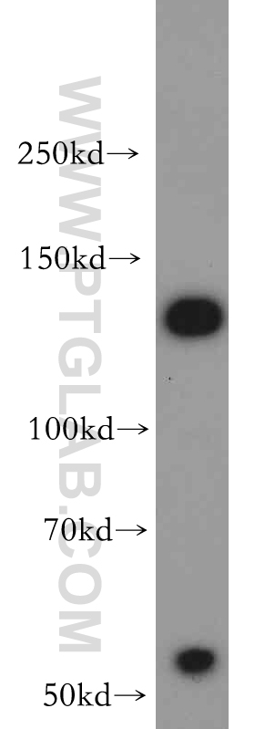 WB analysis of HepG2 using 20810-1-AP