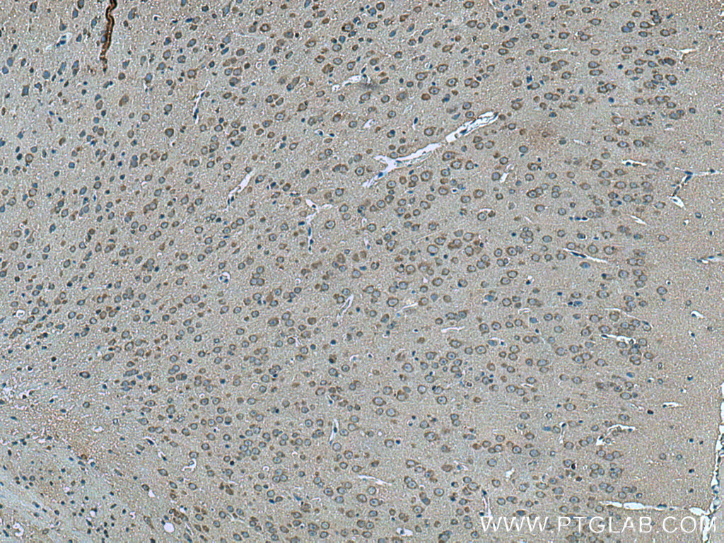IHC staining of mouse brain using 28738-1-AP