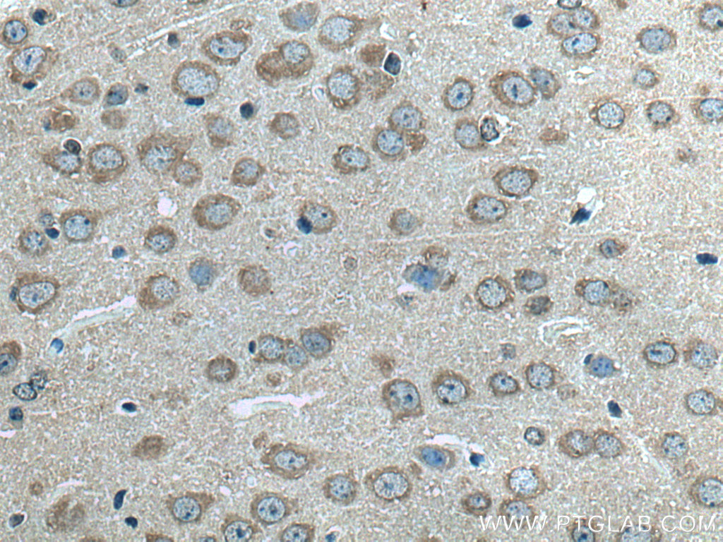 IHC staining of mouse brain using 28738-1-AP