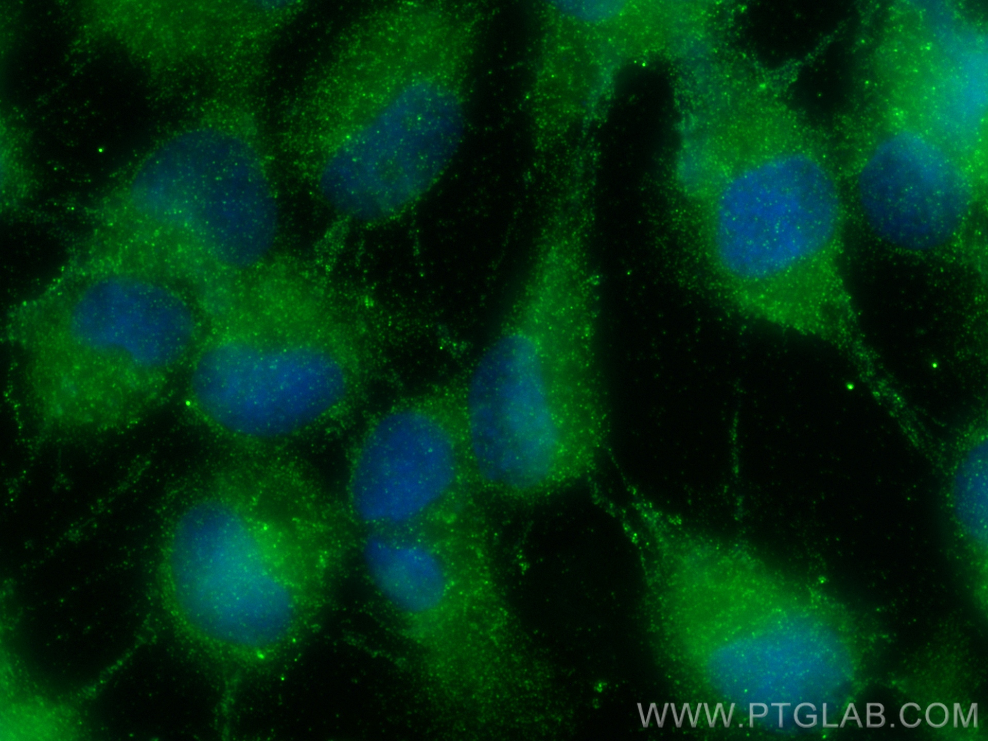 IF Staining of A431 using 16207-1-AP