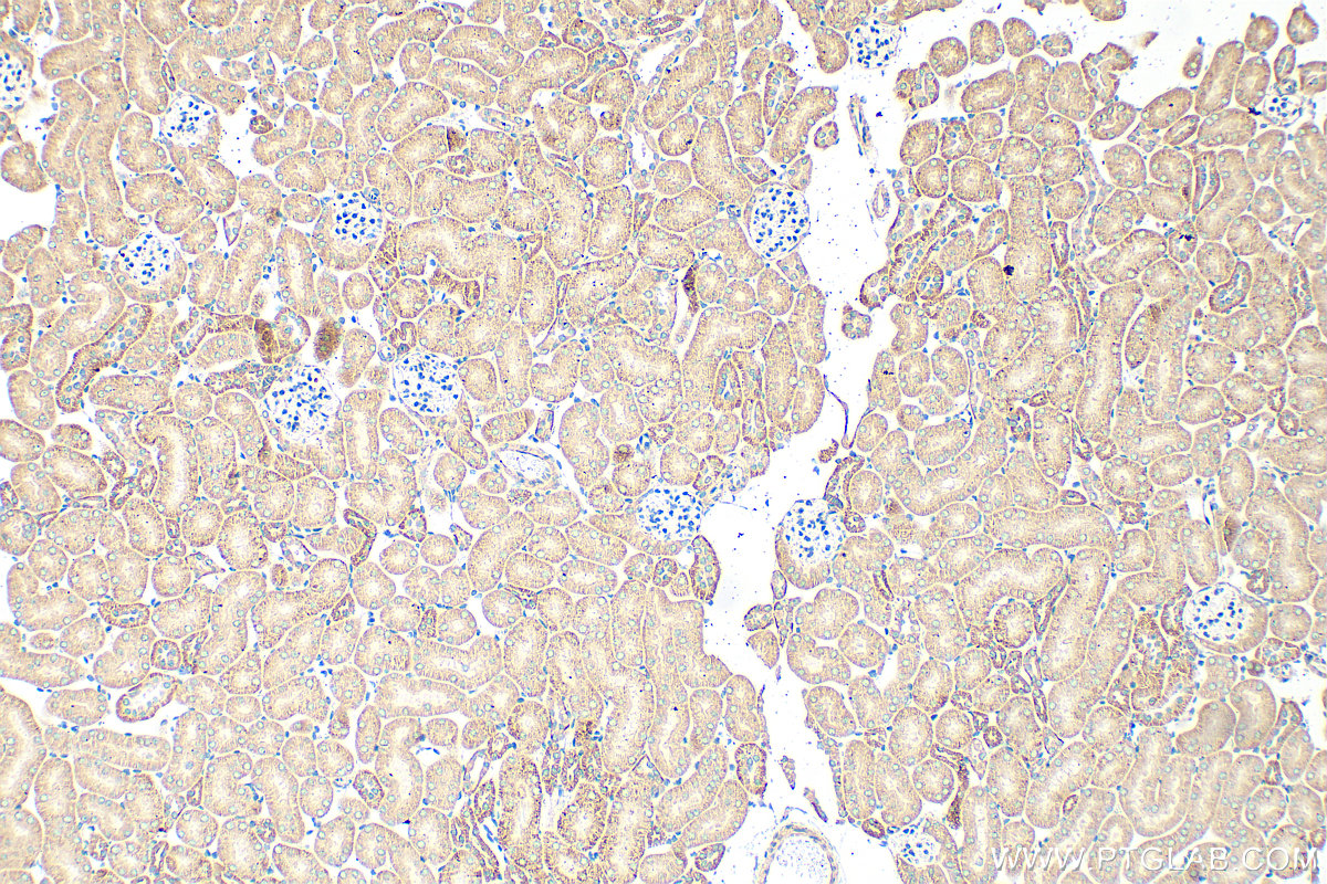 IHC staining of mouse kidney using 16207-1-AP