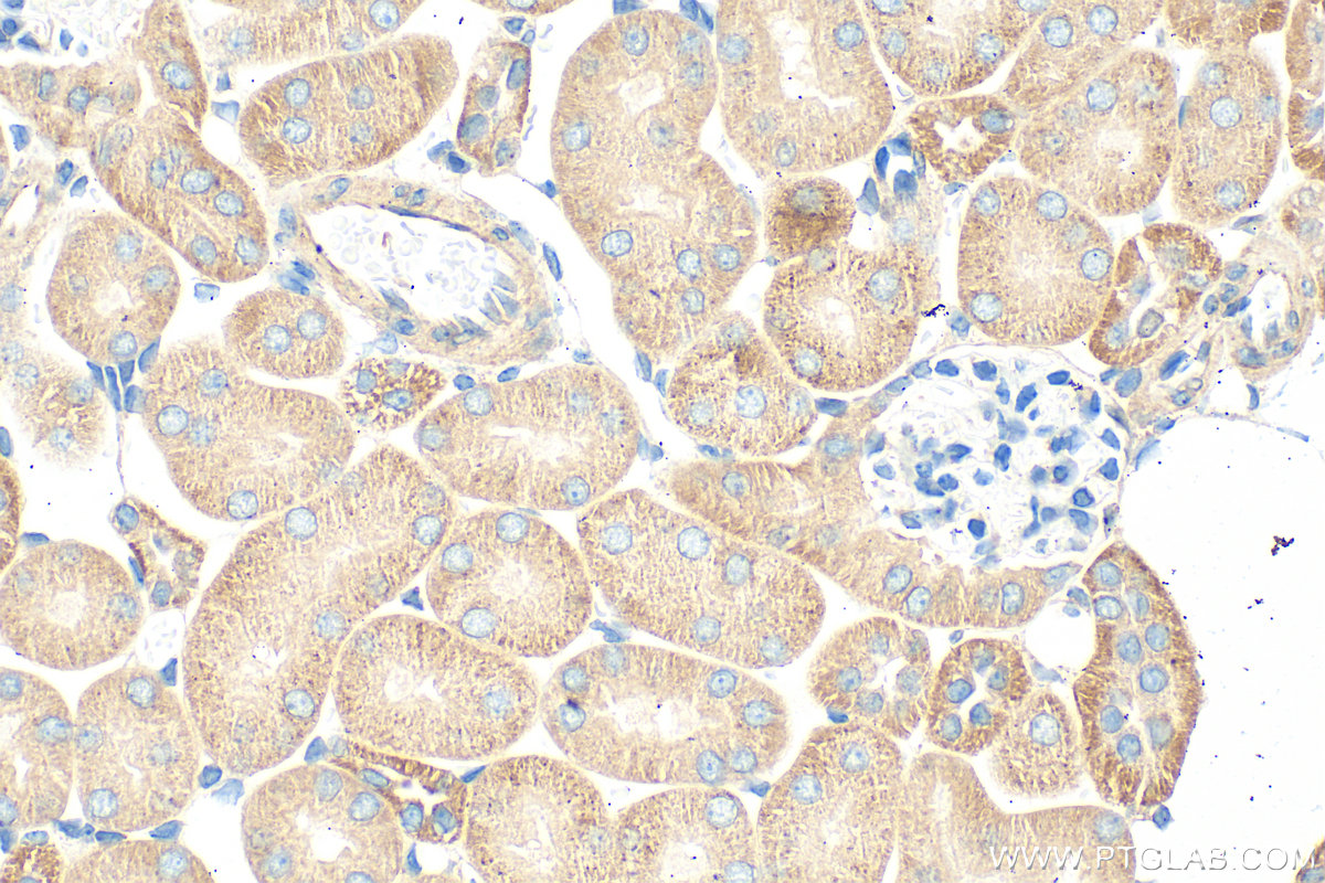 IHC staining of mouse kidney using 16207-1-AP
