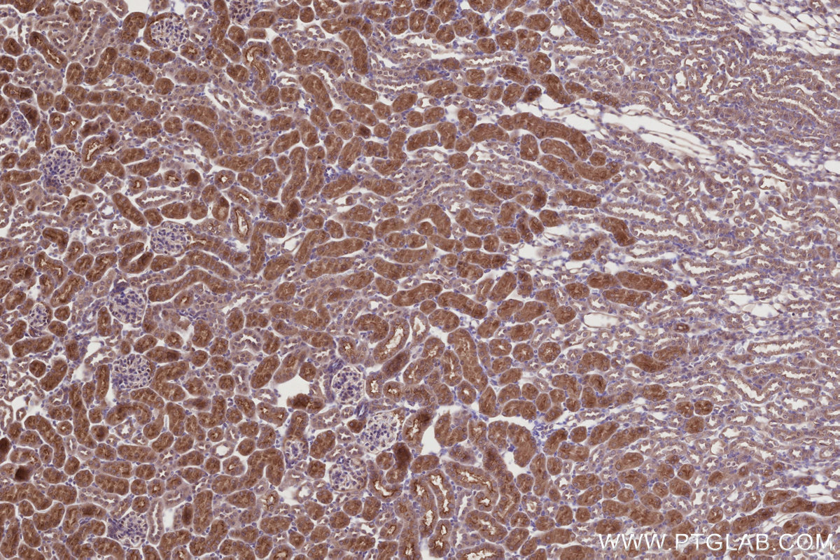 IHC staining of mouse kidney using 28084-1-AP IHC staining of mouse kidney using 28084-1-AP