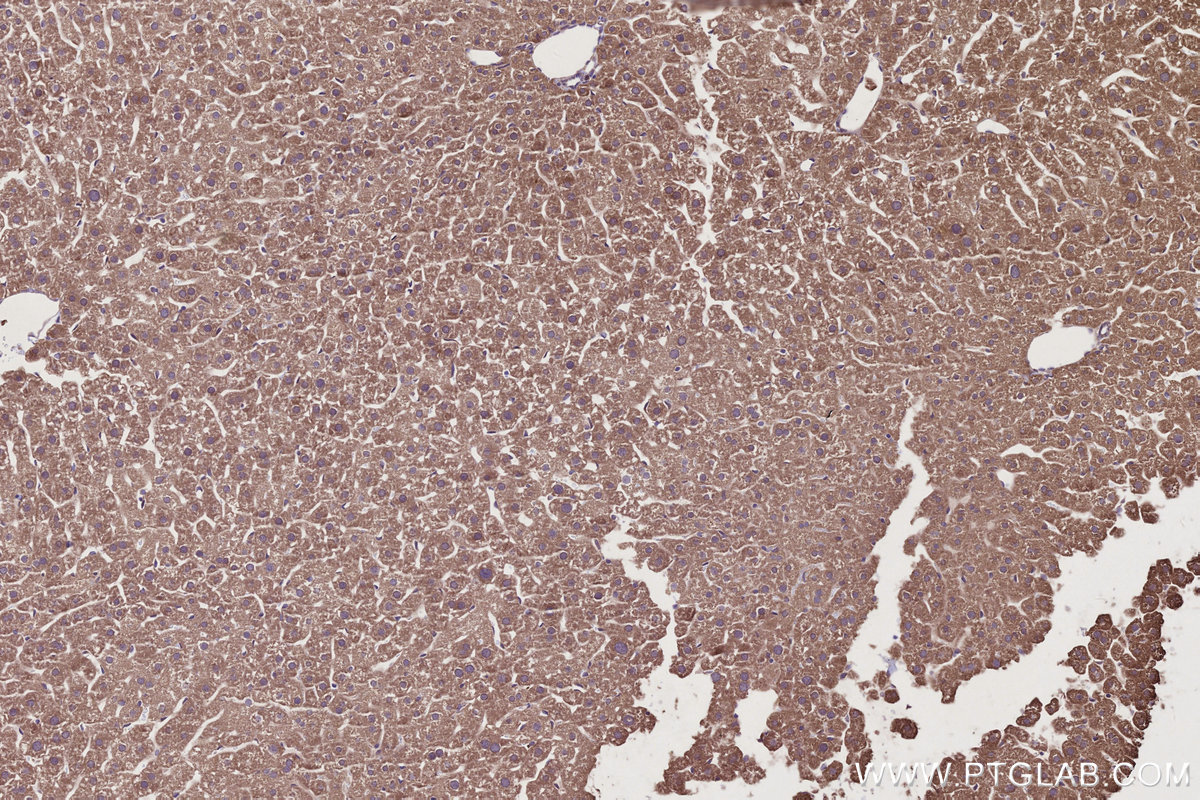 IHC staining of mouse liver using 28084-1-AP IHC staining of mouse liver using 28084-1-AP