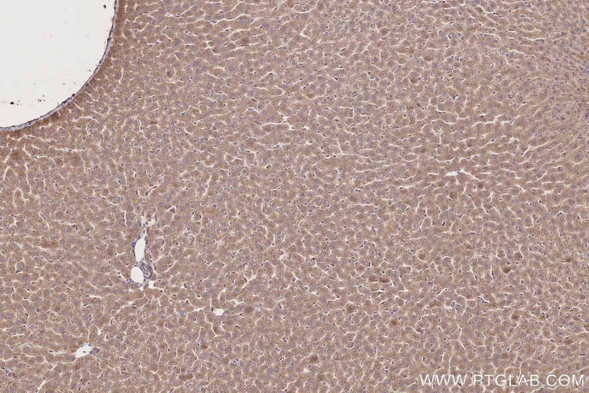 IHC staining of rat liver using 28084-1-AP IHC staining of rat liver using 28084-1-AP