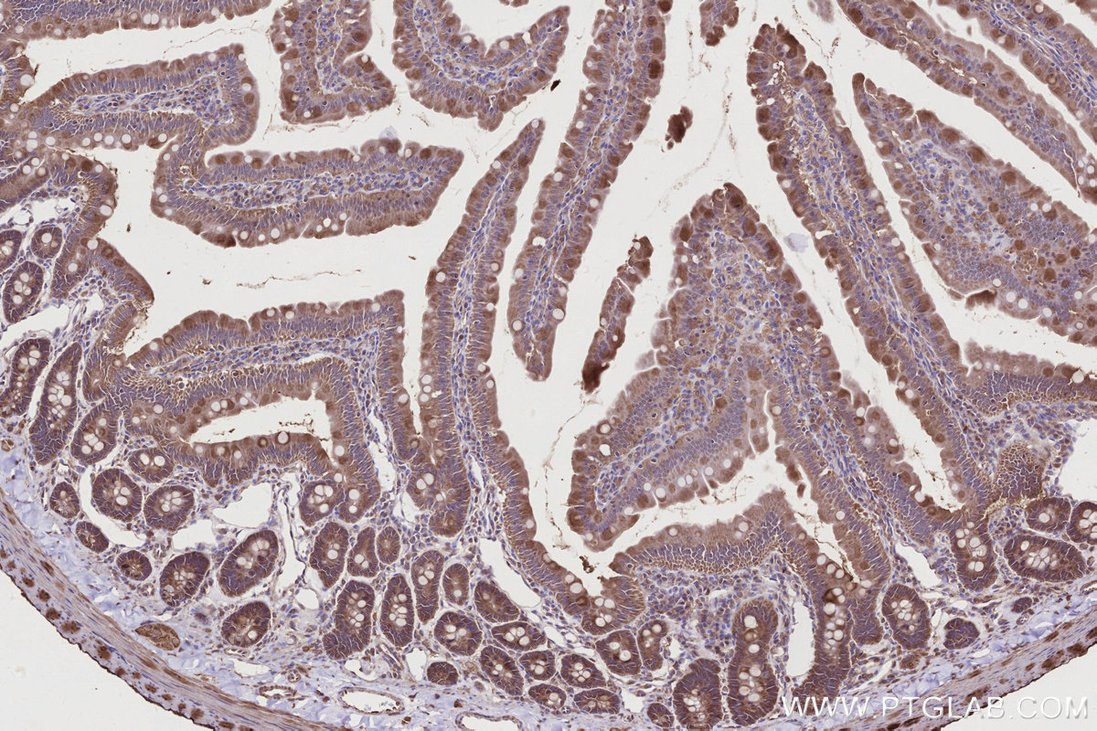 IHC staining of rat small intestine using 28084-1-AP IHC staining of rat small intestine using 28084-1-AP