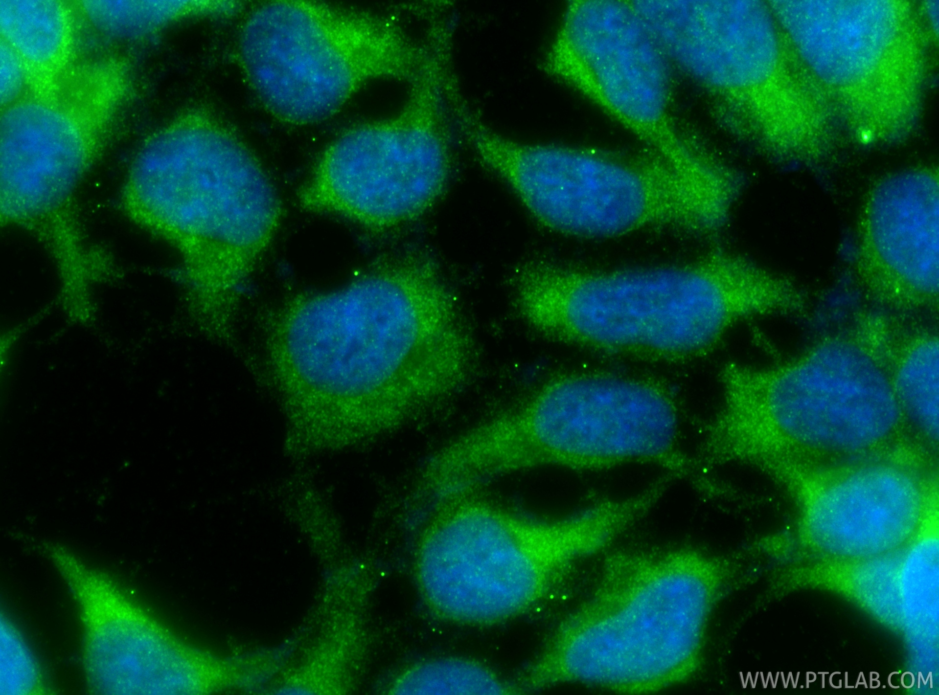 IF Staining of HEK-293 using 16046-1-AP IF Staining of HEK-293 using 16046-1-AP