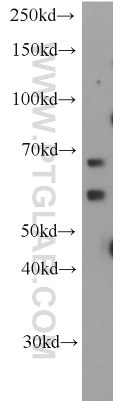 WB analysis of HeLa using 20753-1-AP