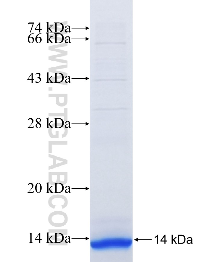 ALG8 fusion protein Ag16939 SDS-PAGE