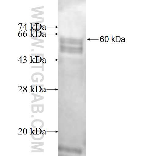 ALG9 fusion protein Ag1291 SDS-PAGE ALG9 fusion protein Ag1291 SDS-PAGE