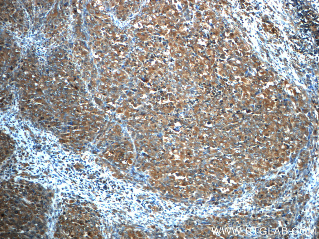 ALK Monoclonal antibody